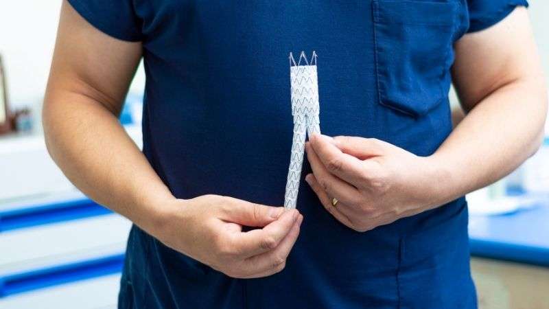 Trajtimi intervenues i aneurizmës së aortës
