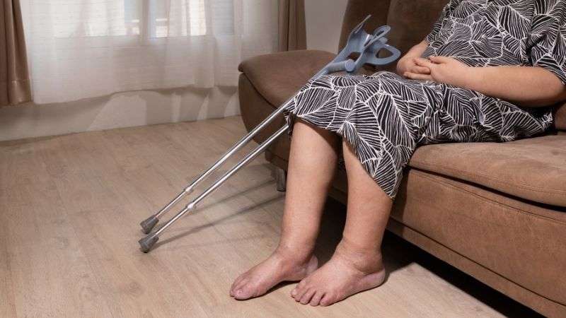 Tromboza e venave të thella (DVT). Mbyllja e venave të këmbës